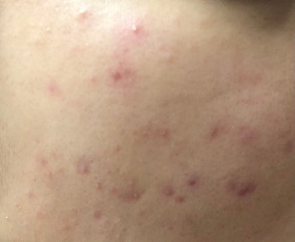 ヘデラヘリックス バランスクリーム/Milk Touch/フェイスクリームを使ったクチコミ(2枚目)