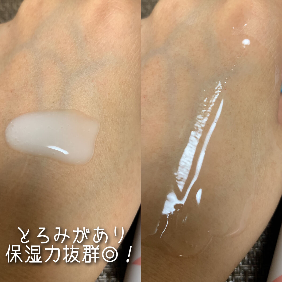 スキンピールバー ティートゥリー/サンソリット/洗顔石鹸を使ったクチコミ（3枚目）