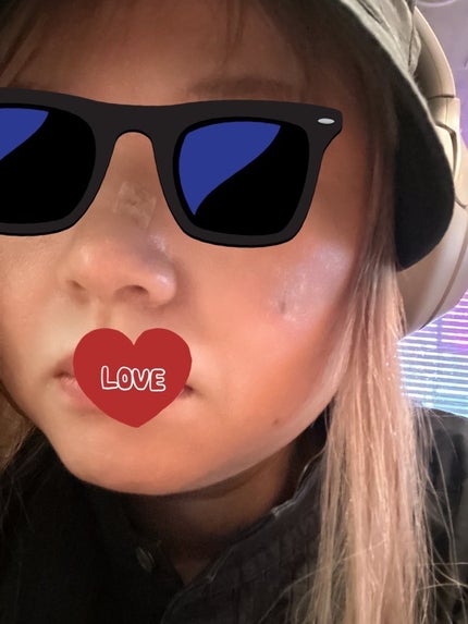 マイクロポア/3M nexcare/その他を使ったクチコミ(1枚目)