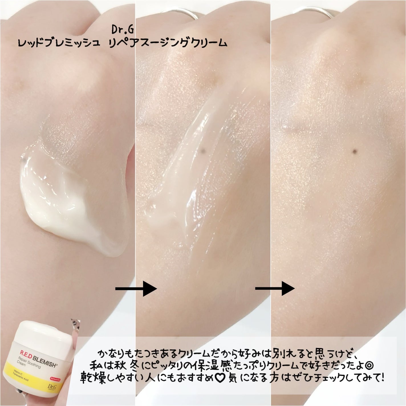 レッドブレミッシュ リペアスージングクリーム/Dr.G/フェイスクリームを使ったクチコミ(3枚目)
