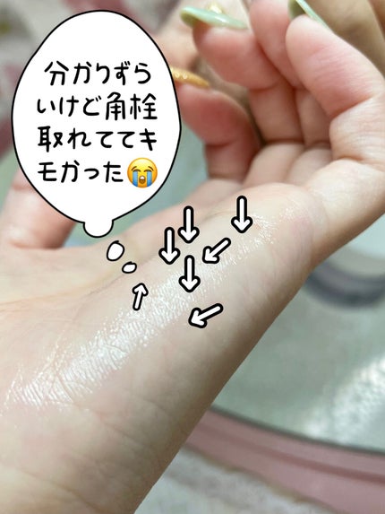 ソフティモ クリアプロ 酵素クレンジングオイル/ソフティモ/オイルクレンジングを使ったクチコミ(1枚目)