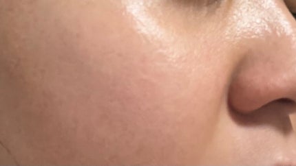 なち on LIPS 「29歳(今年30歳)アラサー女のスキンケア25歳ごろからお肌の..」(4枚目)