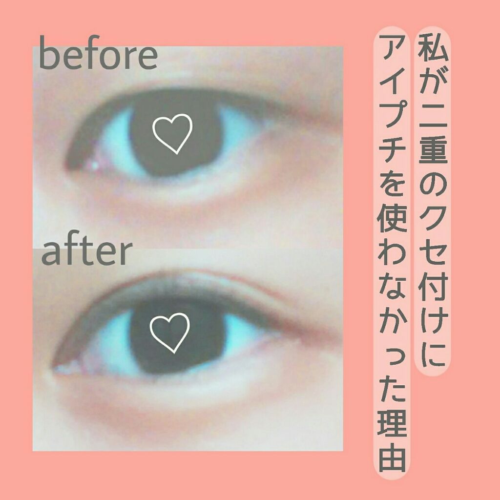 絆創膏/DAISO/その他を使ったクチコミ（1枚目）