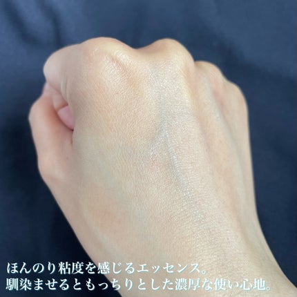 ルルルン ハイドラ V マスク/ルルルン/シートマスク・パックを使ったクチコミ(4枚目)