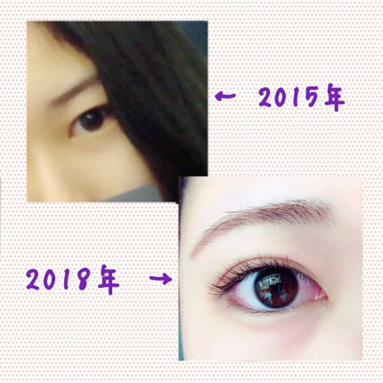 こむぎ on LIPS 「わたしが奥二重から二重になれた2つの方法について書きたいと思い..」(2枚目)