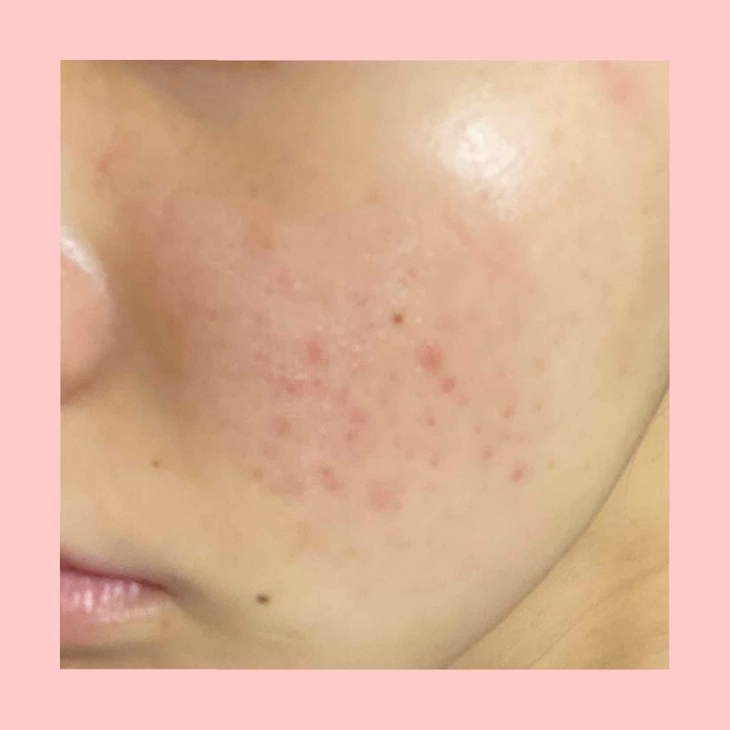 ニベアクリーム/ニベア/ボディクリームを使ったクチコミ(2枚目)