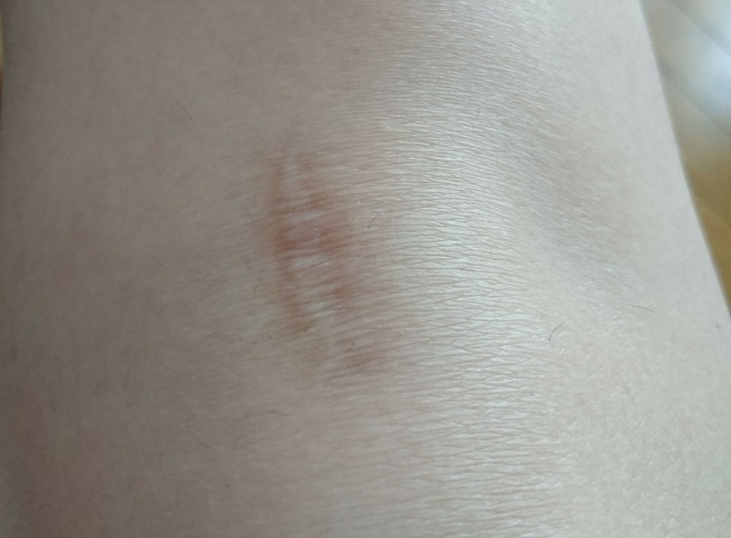 スポッツカバー ファウンデイション/SHISEIDO/クリームコンシーラーを使ったクチコミ（3枚目）