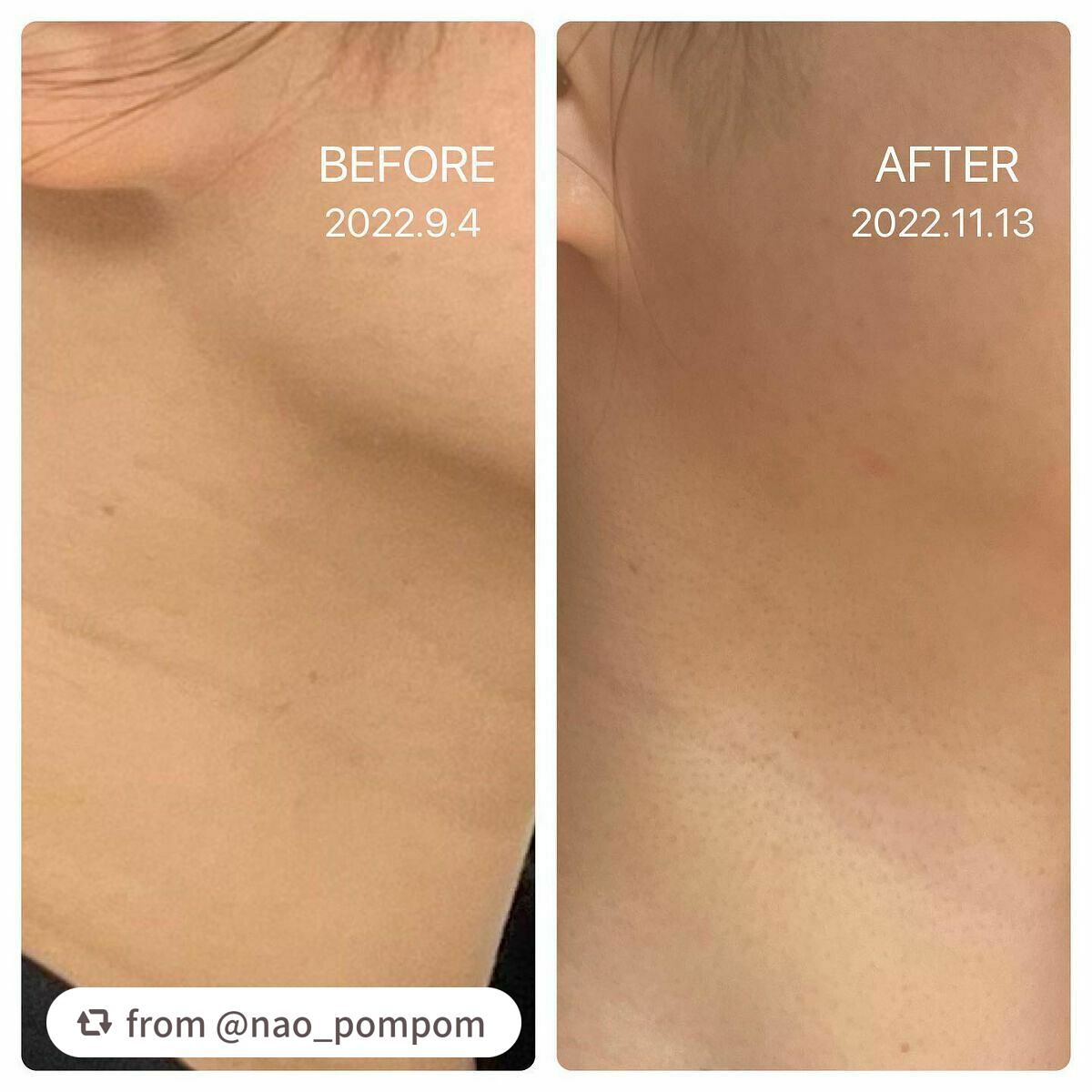 ネイチャーコンク 薬用リンクルケアジェルクリーム/ネイチャーコンク/オールインワン化粧品を使ったクチコミ(4枚目)