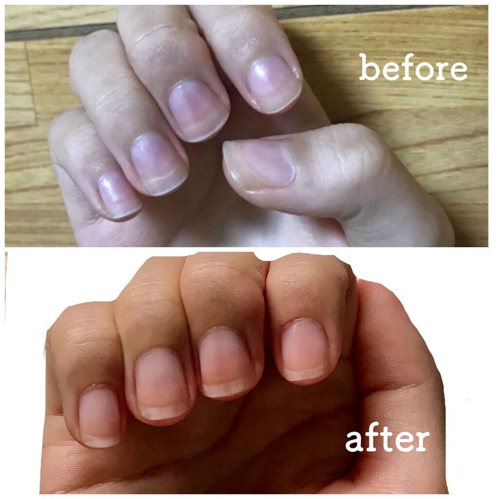 キューティクルオイル/ネイルホリック/ネイルオイル・トリートメントを使ったクチコミ（2枚目）