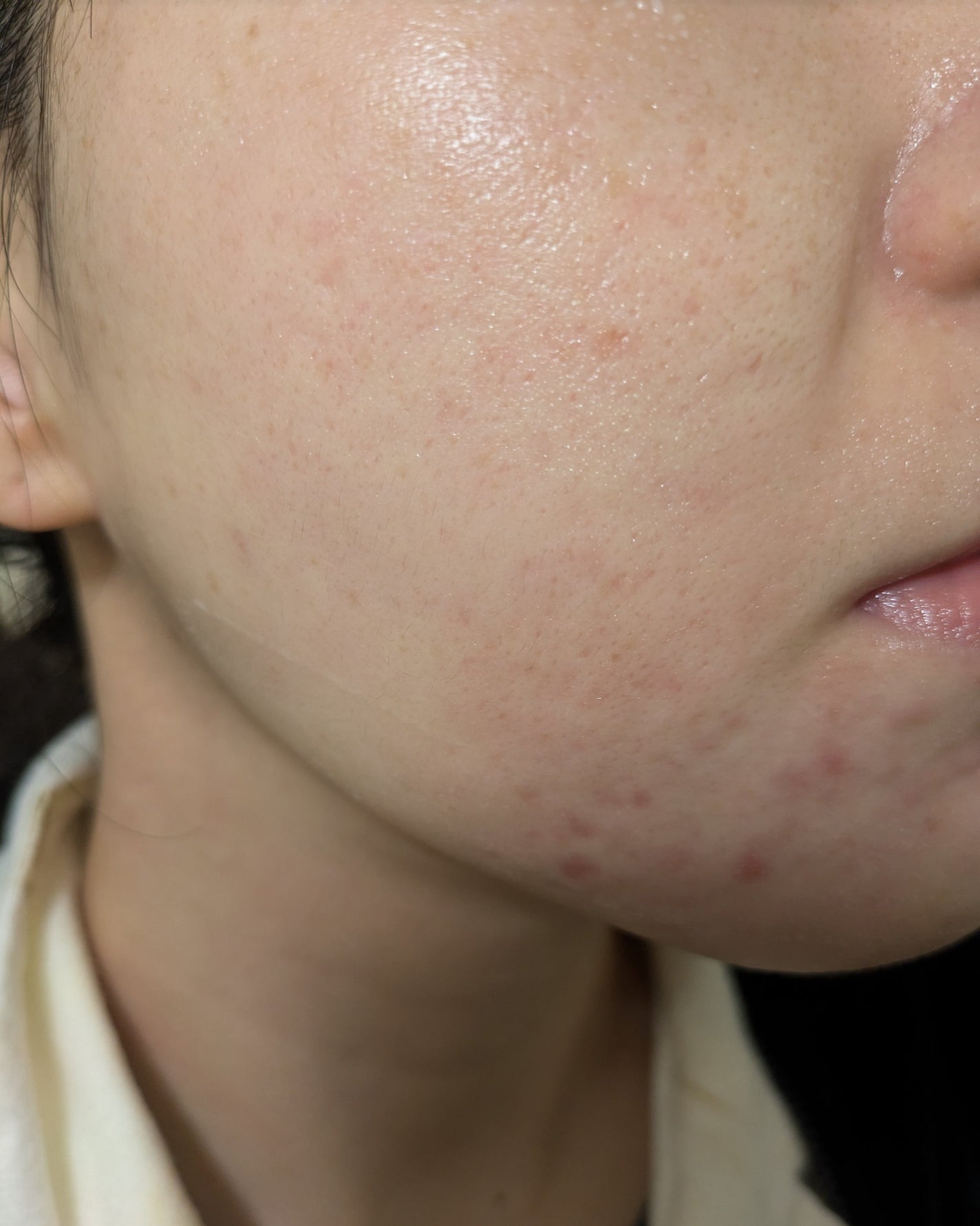 miina@汚肌工事録⚠️ on LIPS 「11/1の#汚肌工事録💐肌がのためにやっていること💊乳酸菌やビ..」(1枚目)