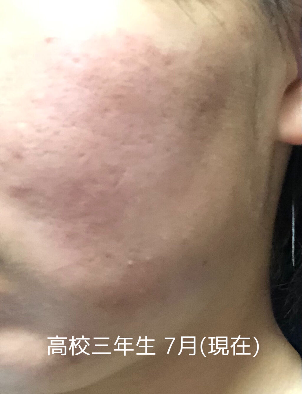 ハトムギ化粧水(ナチュリエ スキンコンディショナー R )/ナチュリエ/化粧水を使ったクチコミ（2枚目）