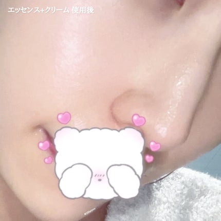 グルカミューンクリーム/VT/フェイスクリームを使ったクチコミ(5枚目)