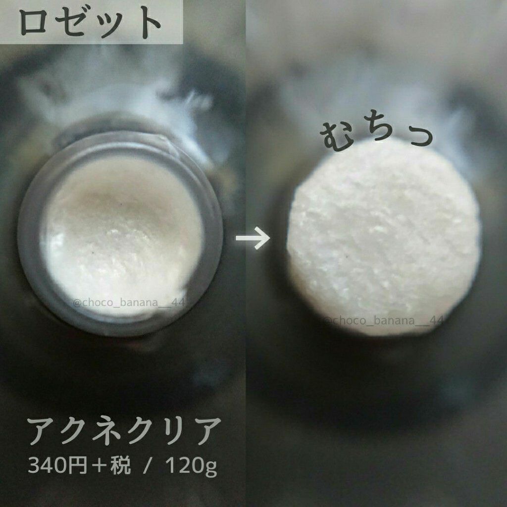 ロゼット洗顔パスタ アクネクリア/ロゼット/洗顔フォームを使ったクチコミ(3枚目)