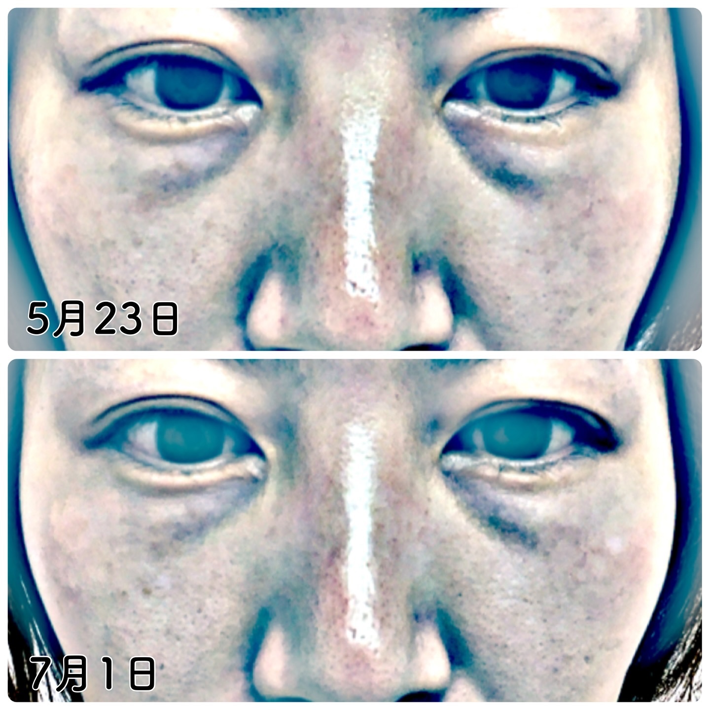 Cemenrete Calcium Intense Cream/Dr.Melaxin/フェイスクリームを使ったクチコミ（3枚目）