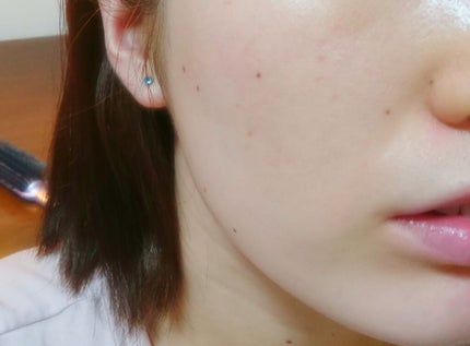 ãªãæ±° on LIPS ãðµïžãã確å®ã§ããðµïžãªãã¢&ãã©ã³ã¹ãã€ã«ãããŒã·ã§ã³ææè..ãïŒ4æç®ïŒ