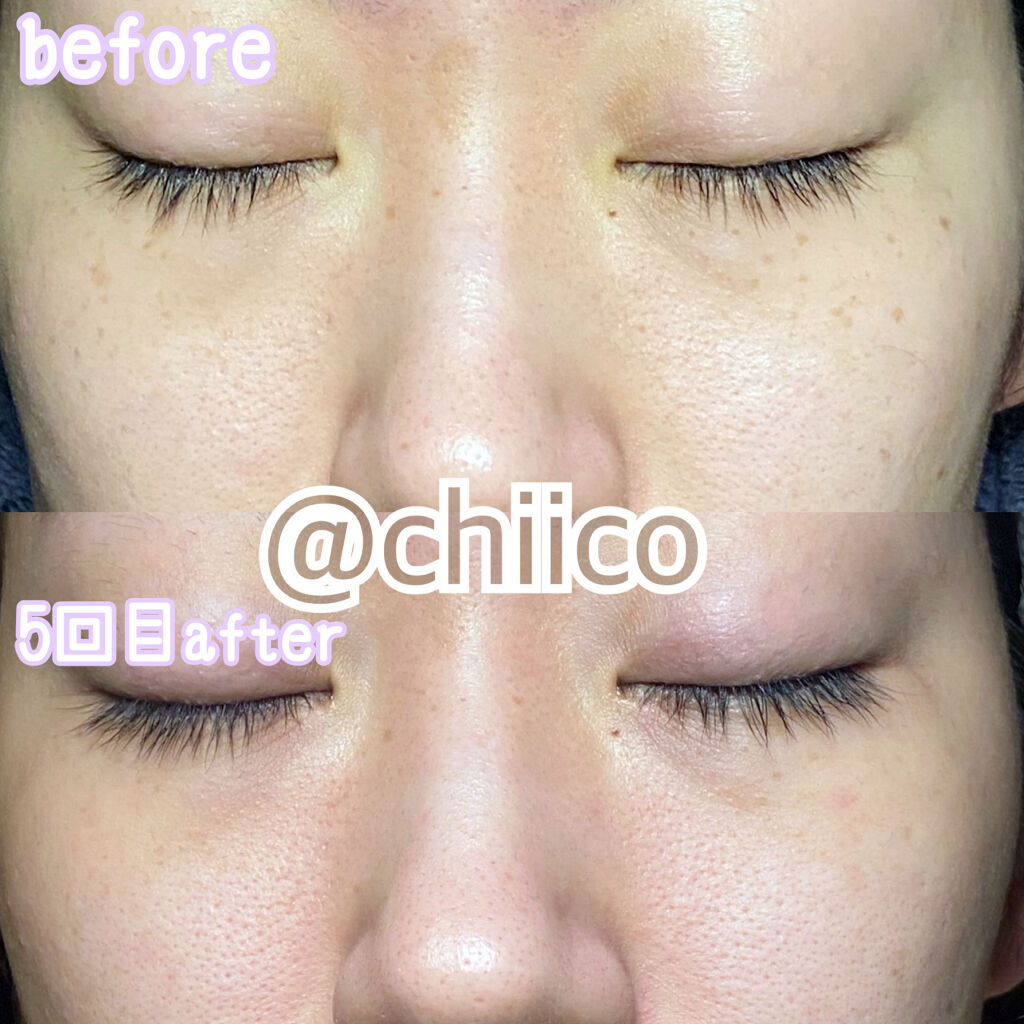 を使ったクチコミ（2枚目）