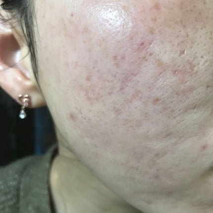 N10+Z1フェイスセラム /The Ordinary/美容液を使ったクチコミ(1枚目)