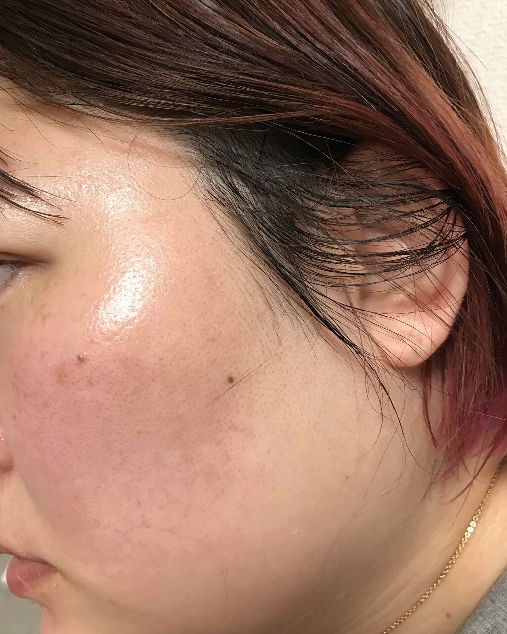 保湿液(旧)/ドモホルンリンクル/化粧水を使ったクチコミ(2枚目)