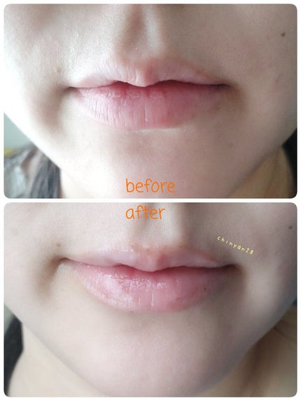 ハニーフルリップ もも色ボリューム/カントリー&ストリーム/リップ美容液を使ったクチコミ(5枚目)