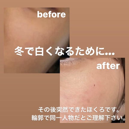 スキンアクア スーパーモイスチャージェル/スキンアクア/日焼け止めジェルを使ったクチコミ(1枚目)