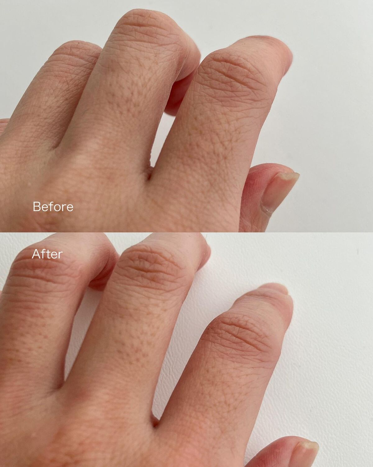 薬用ブラックリムーバー/RODOMIS/除毛クリームを使ったクチコミ（3枚目）