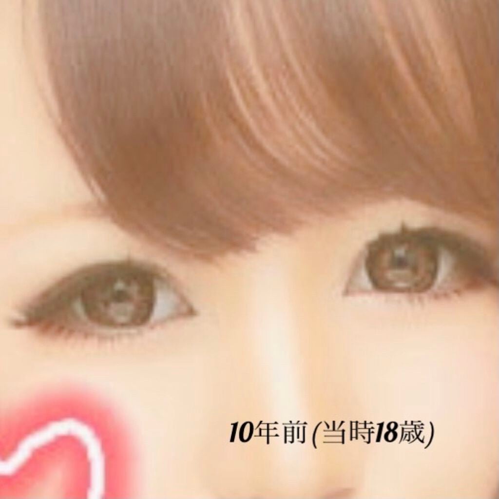 みさこ on LIPS 「こんにちは🌞昔の写真見てたら懐かしくなったので二重の変化につい..」(2枚目)