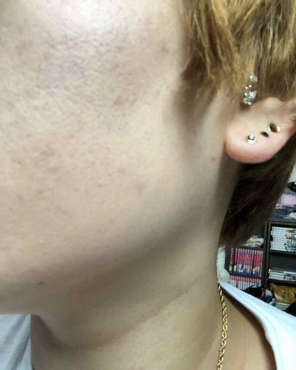 【旧】ディオールスキン フォーエヴァー クッション/Dior/クッションファンデーションを使ったクチコミ(4枚目)