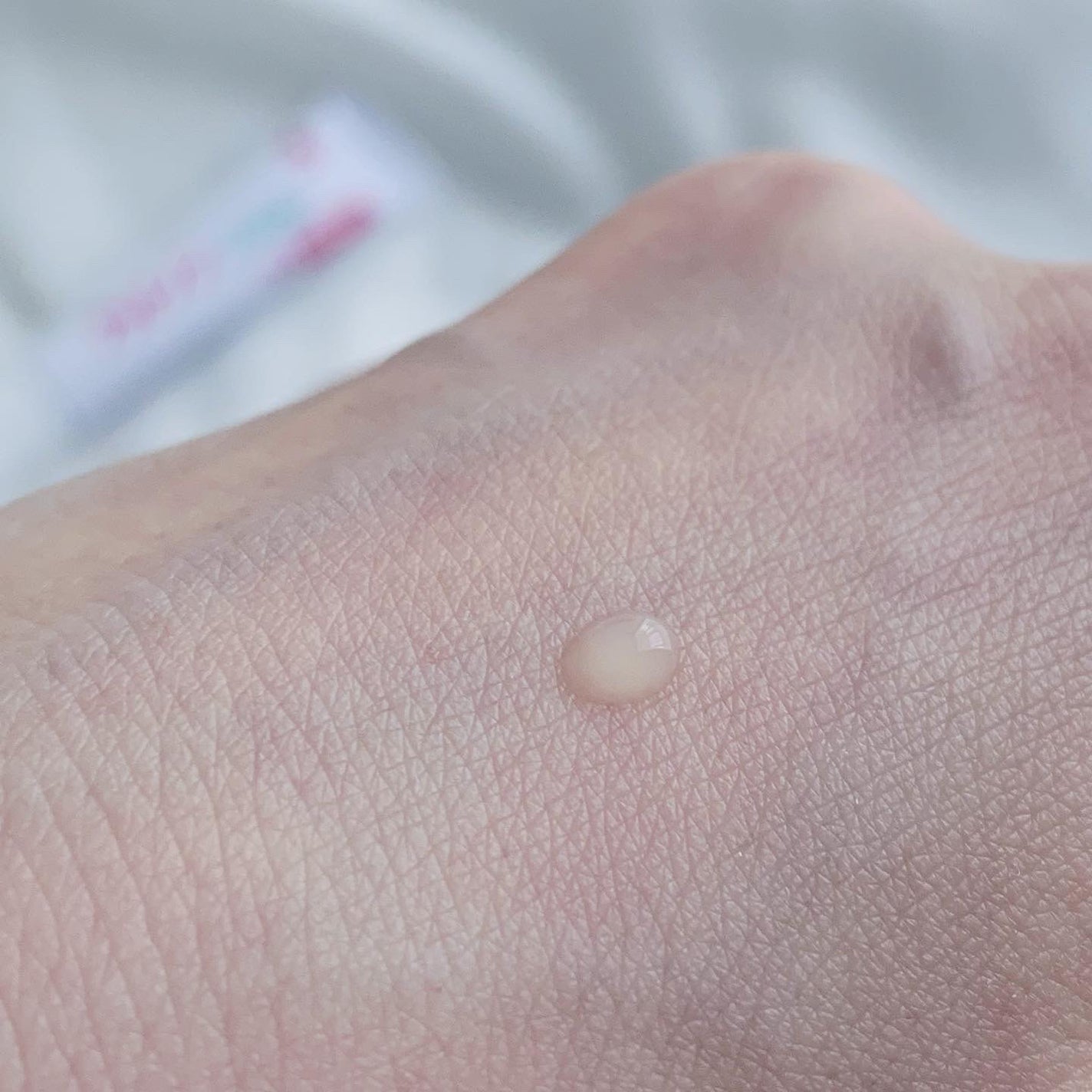 ニキビあとケアジェル/アットノン/その他スキンケアを使ったクチコミ(6枚目)