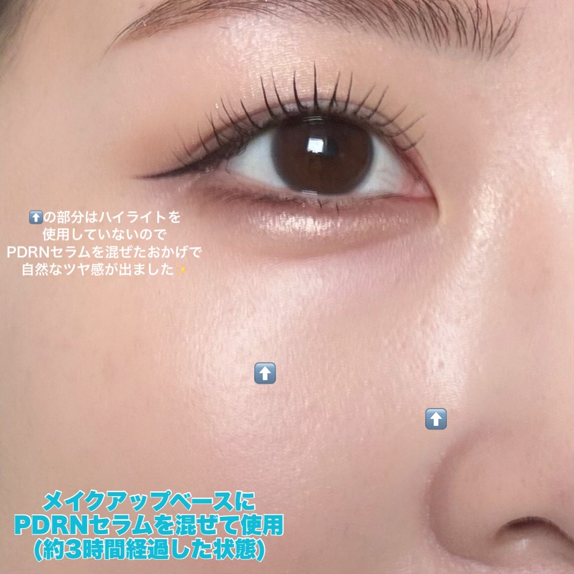 PDRNヒアルロン酸カプセル100セラム/Anua/美容液を使ったクチコミ(3枚目)