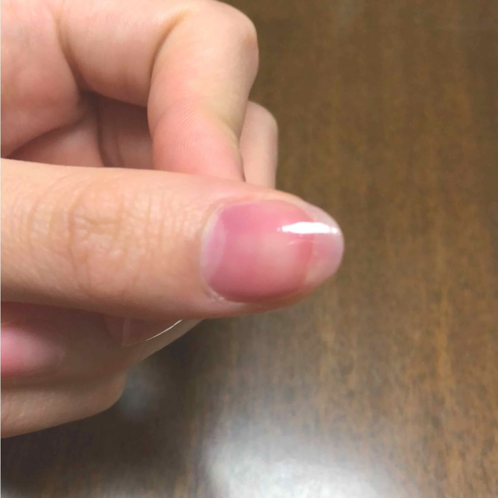 サンリオネイル/DAISO/マニキュアを使ったクチコミ（3枚目）