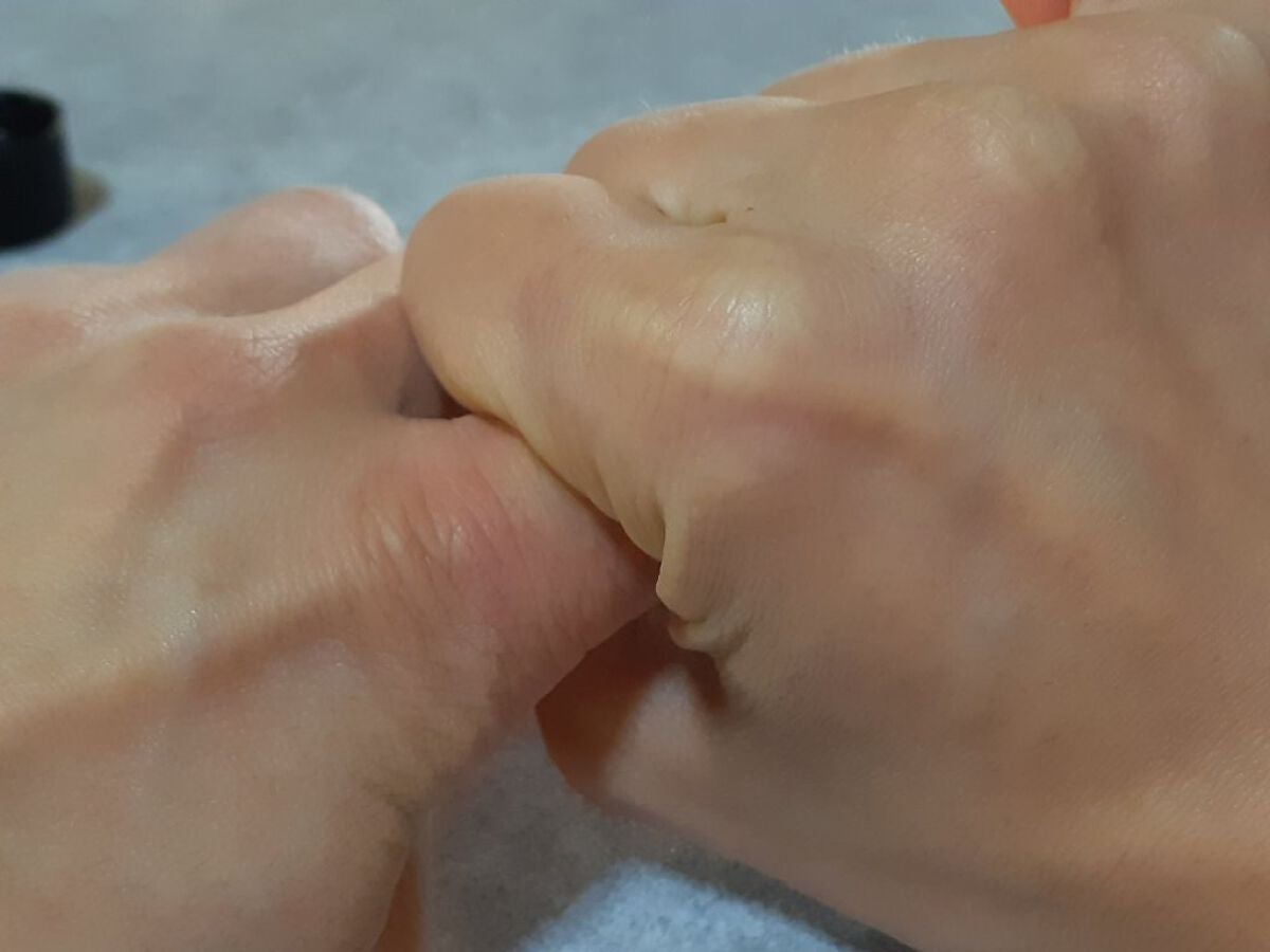 キズクイック/東洋化学/その他を使ったクチコミ(4枚目)