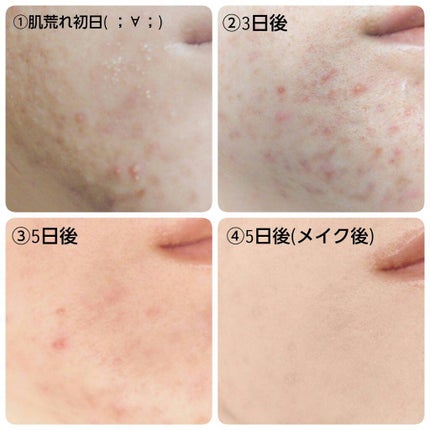 アルビオン 薬用スキンコンディショナー エッセンシャル/ALBION/化粧水を使ったクチコミ(7枚目)