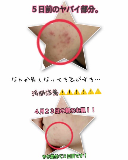 美容液 ノンアルコールタイプ/ちふれ/美容液を使ったクチコミ(4枚目)