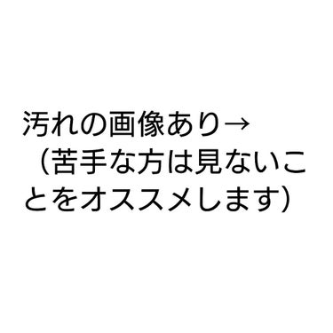 ヤーマン ダブルピーリングプロのクチコミ「洗顔では取れない肌の汚れをごっそり落とす。

半年愛用している、買ってよかった美顔器の紹介です.....」（2枚目）