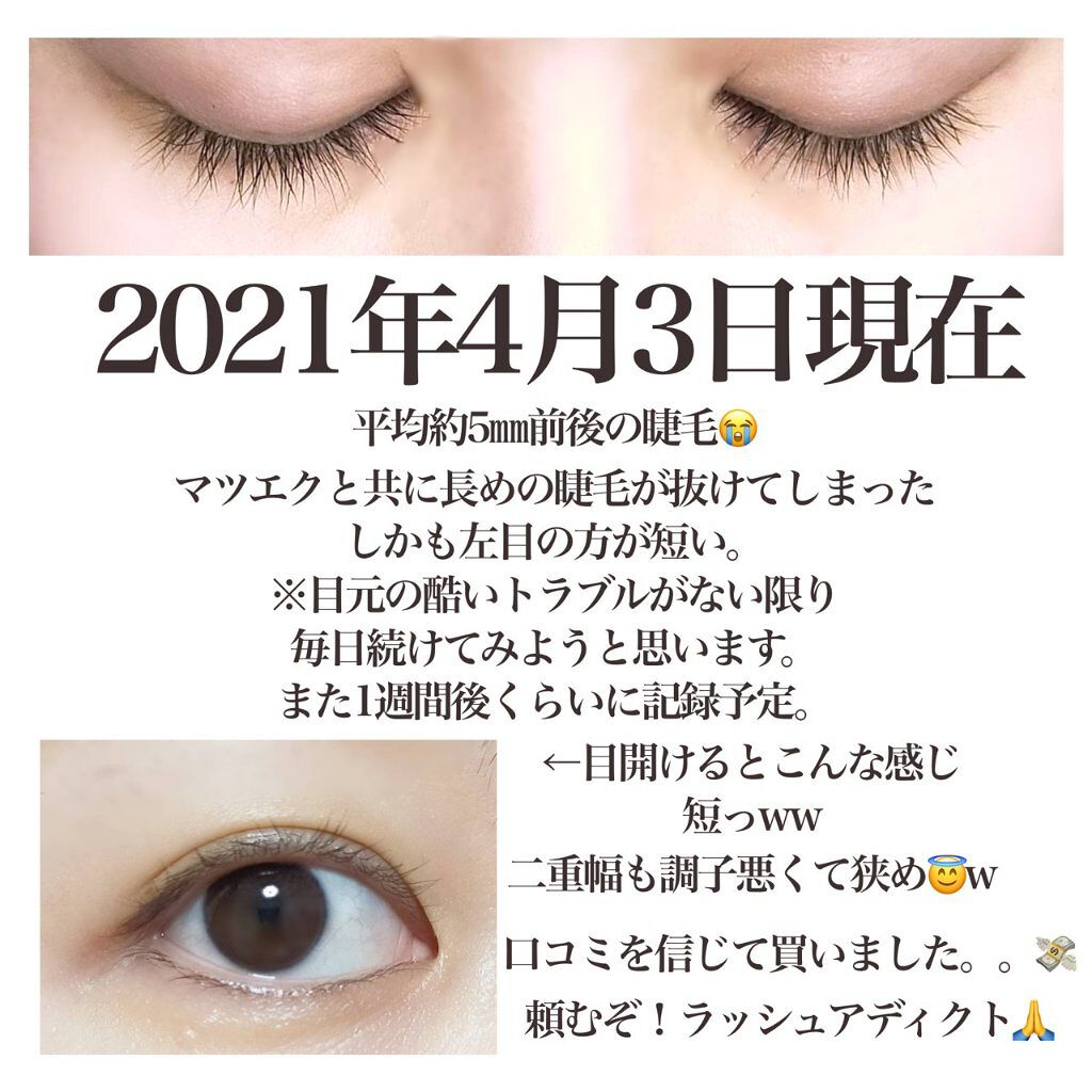 ラッシュアディクト アイラッシュコンディショニングセラム/soaddicted/まつげ美容液を使ったクチコミ（2枚目）