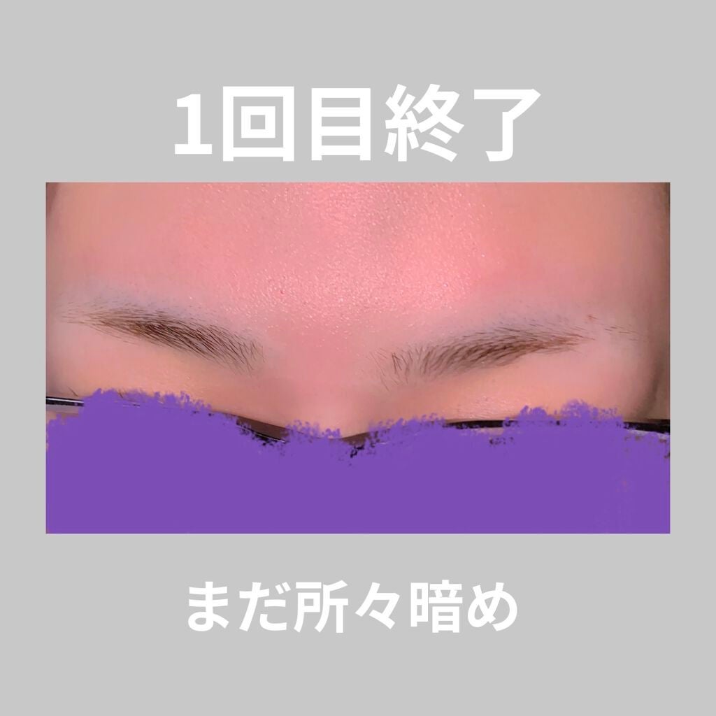 脱色クリーム スピーディー/エピラット/ムダ毛ケアを使ったクチコミ(4枚目)