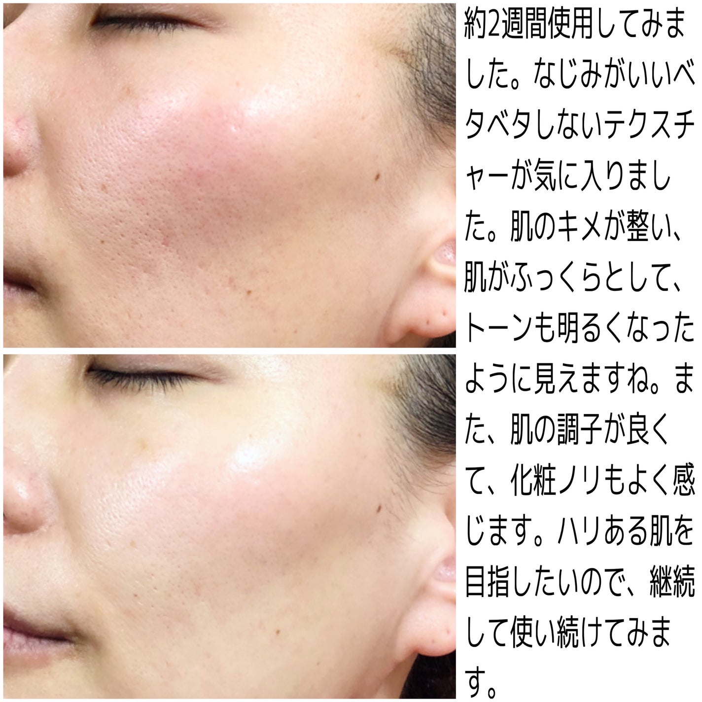 9番 NMNバイオリフト濃縮美容液/numbuzin/美容液を使ったクチコミ(3枚目)