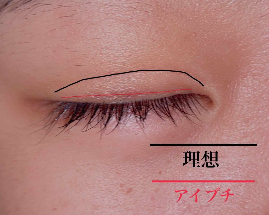 アイビューティー フィクサー WP/アストレア ヴィルゴ/二重まぶた用アイテムを使ったクチコミ(4枚目)