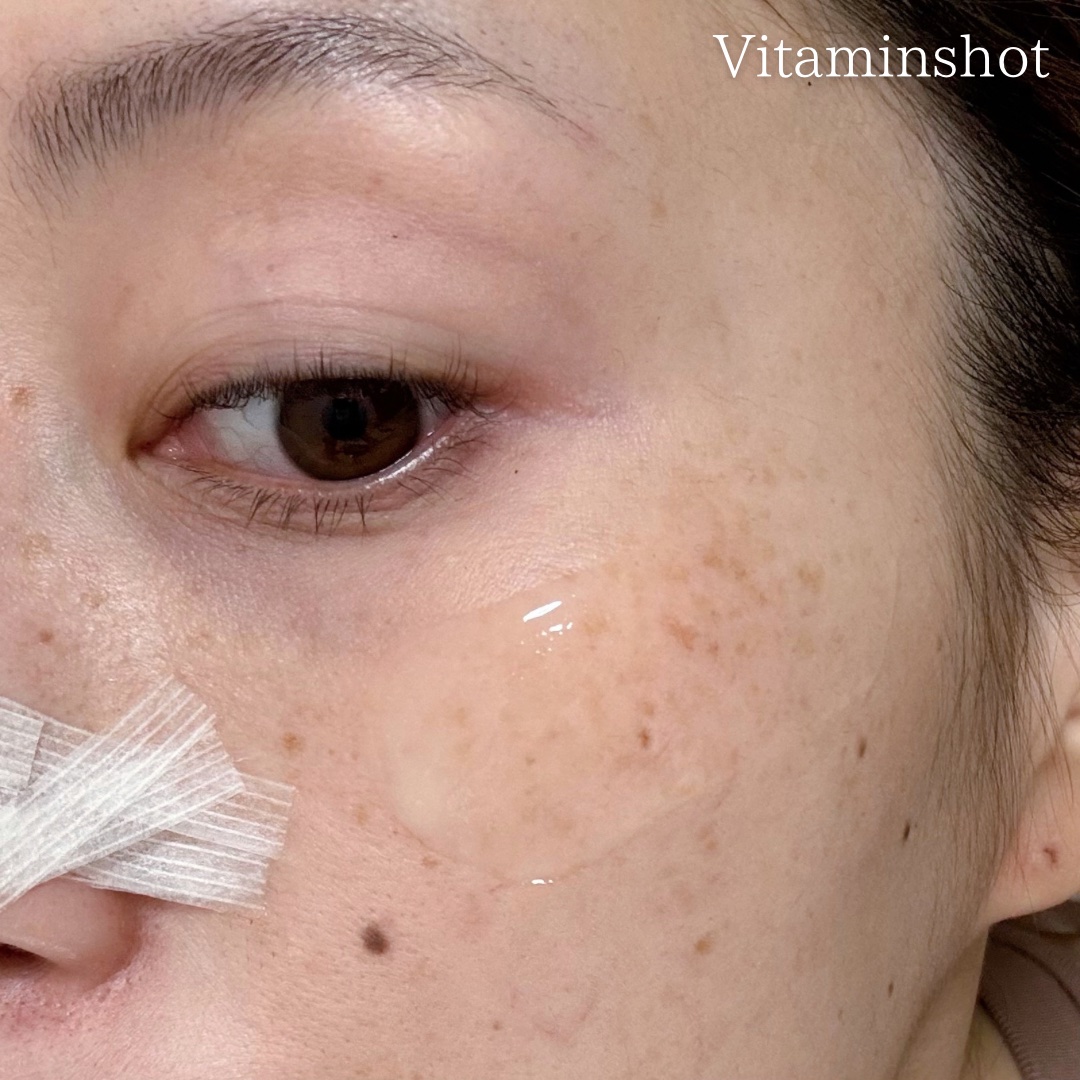 RTXセラム ビタミンショット/Dr.G/美容液を使ったクチコミ（3枚目）