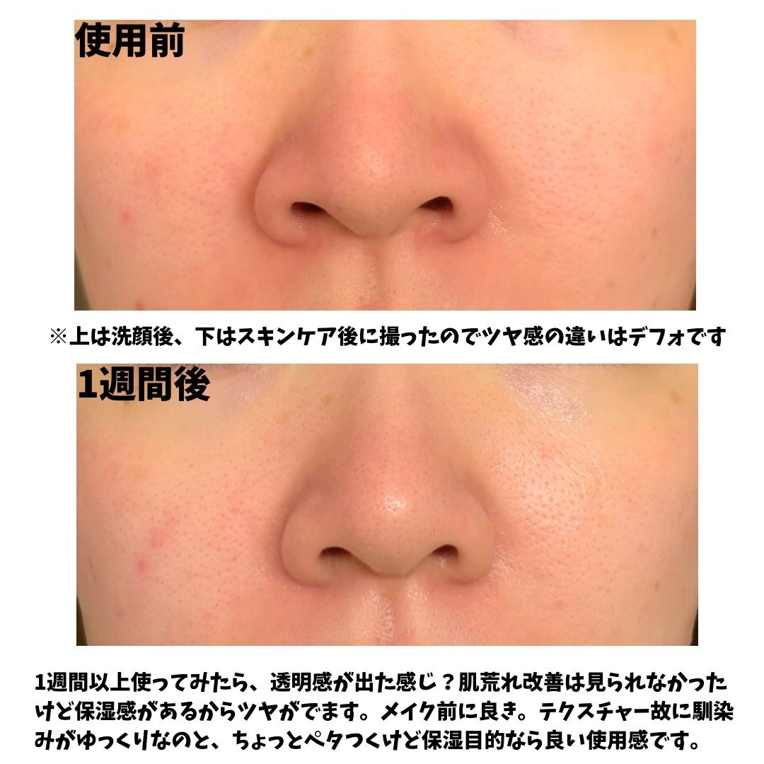 REJURAN デュアルエフェクトアンプル 30ml/REJURAN COSMETICS/美容液を使ったクチコミ(4枚目)