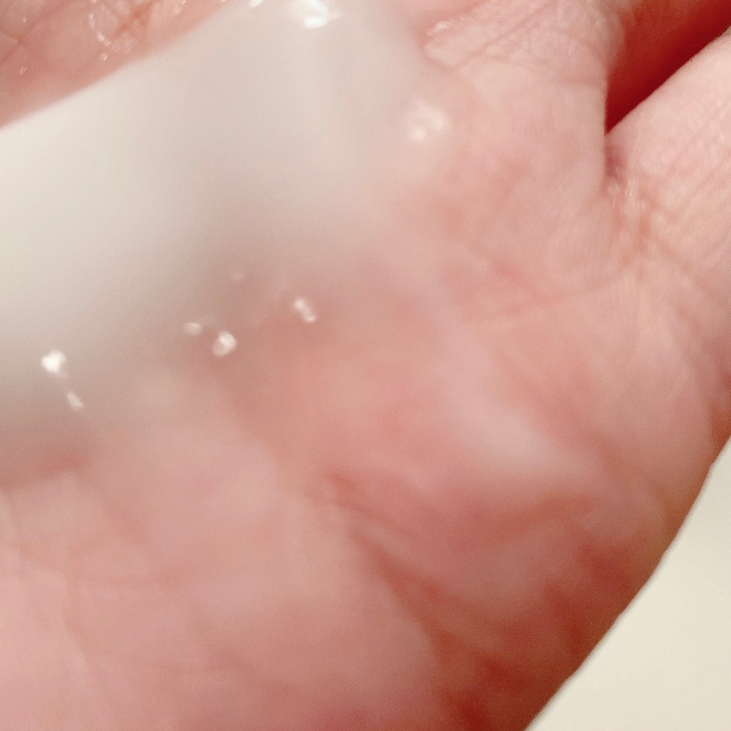 アウトバストリートメント/アキュパラ/アウトバストリートメントを使ったクチコミ(3枚目)