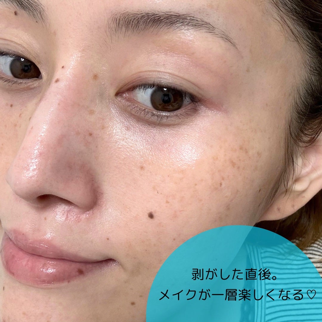 レッドブレミッシュクイックPHAシートマスク/Dr.G/シートマスク・パックを使ったクチコミ(6枚目)