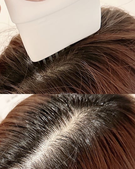 グローターン 100ml/リリーイブ/頭皮ローションを使ったクチコミ(5枚目)