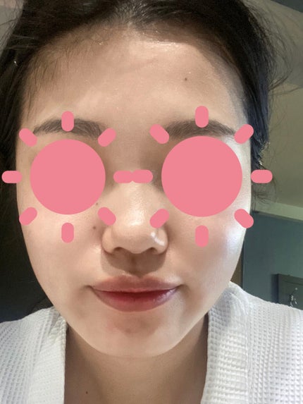 スキンライトセラピーII/Makeon/美顔器・マッサージを使ったクチコミ(4枚目)