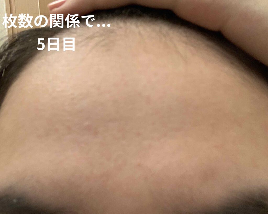 ティーツリーケアソリューション アンプルマスクJEX/MEDIHEAL/シートマスク・パックを使ったクチコミ(4枚目)