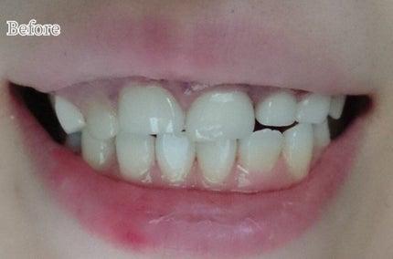 を使ったクチコミ(2枚目)