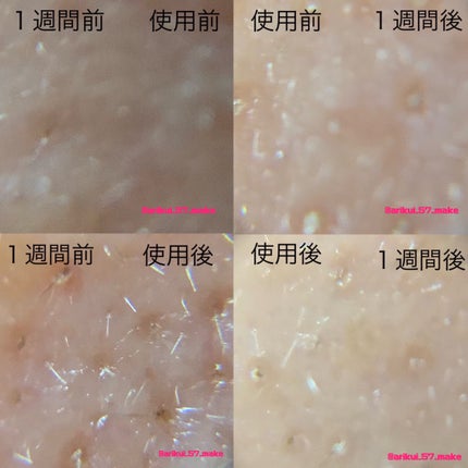 リードルショット300/VT/美容液を使ったクチコミ(8枚目)