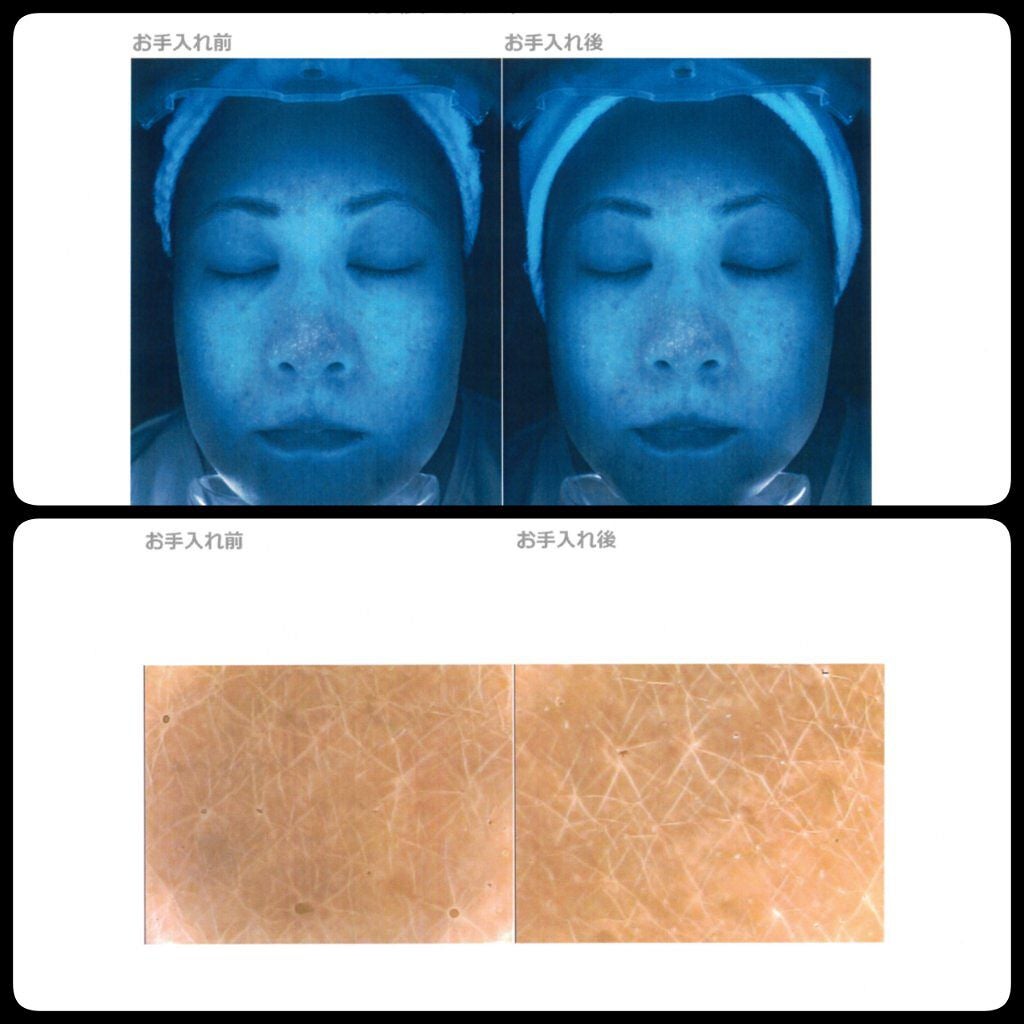 フェイシャリスト ファーメントパウダー/シーボン./その他洗顔料を使ったクチコミ(9枚目)