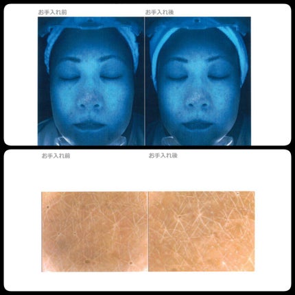 フェイシャリスト ファーメントパウダー/シーボン./その他洗顔料を使ったクチコミ(9枚目)