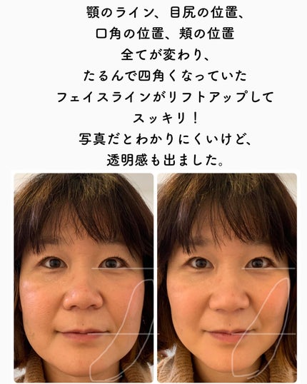 を使ったクチコミ(3枚目)